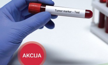 Nova akcija u Poliklinici Vaše zdravlje Tuzla